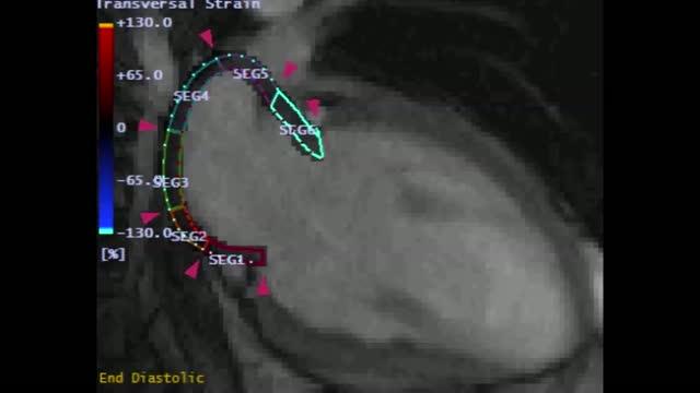 Afib (1 of 2)