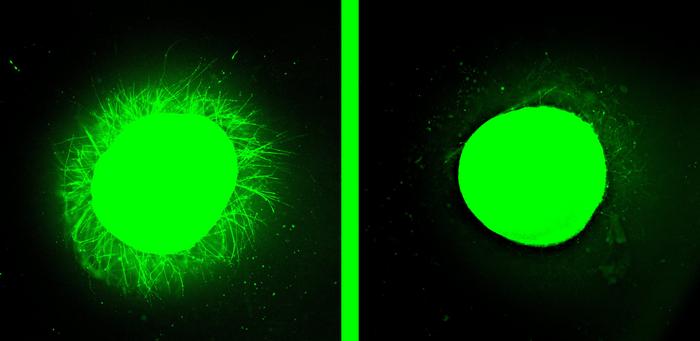 Neurite growth