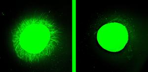 Neurite growth