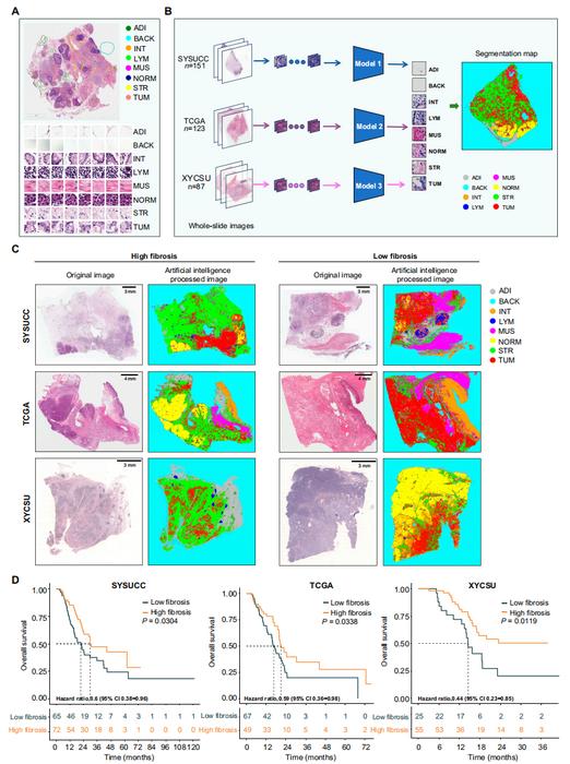 Fig 1. WSI-based fibrosis assessment.