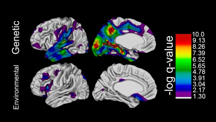 Interhemispheric Correlations