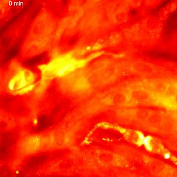 Oscillating Mitochondria in Cardiac Cells Following Heart Attack