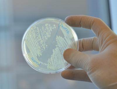 <i>E. coli</i>