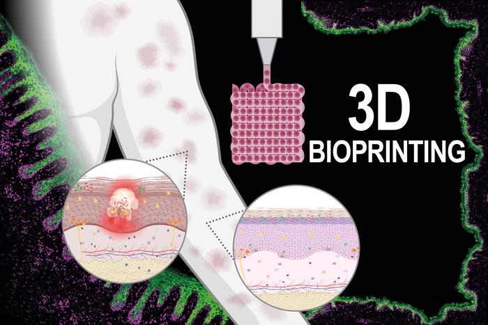 3D Bioprinting