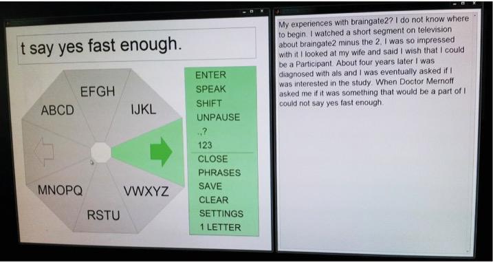 Typing with BrainGate