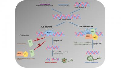 Specific DNA Ligation Defect May Cause Familial Forms of ALS