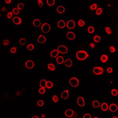 Prostate Cell Membrane