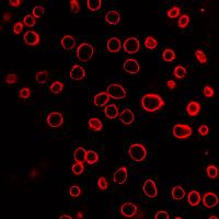 Prostate Cell Membrane