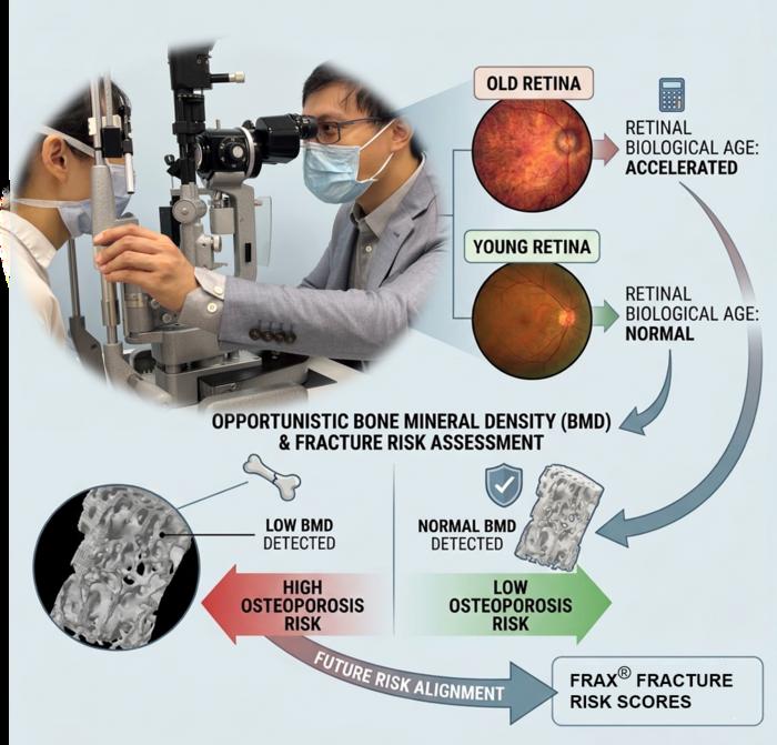 Your retina's biological age might indicate osteoporosis risk