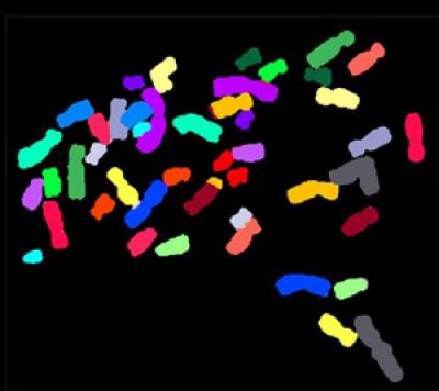 Chromosomes