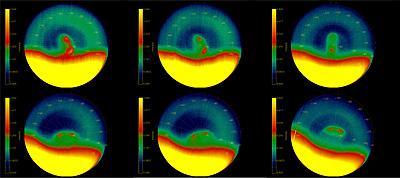 Double Vortex at Venus South Pole