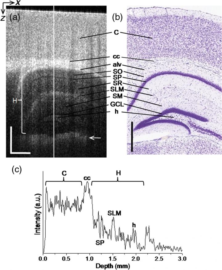 In Vivo 1.3-&mu;m VCSEL SS-OCT Imaging of a 12-Week-Old Adult Mouse with Cranial Window Preparation