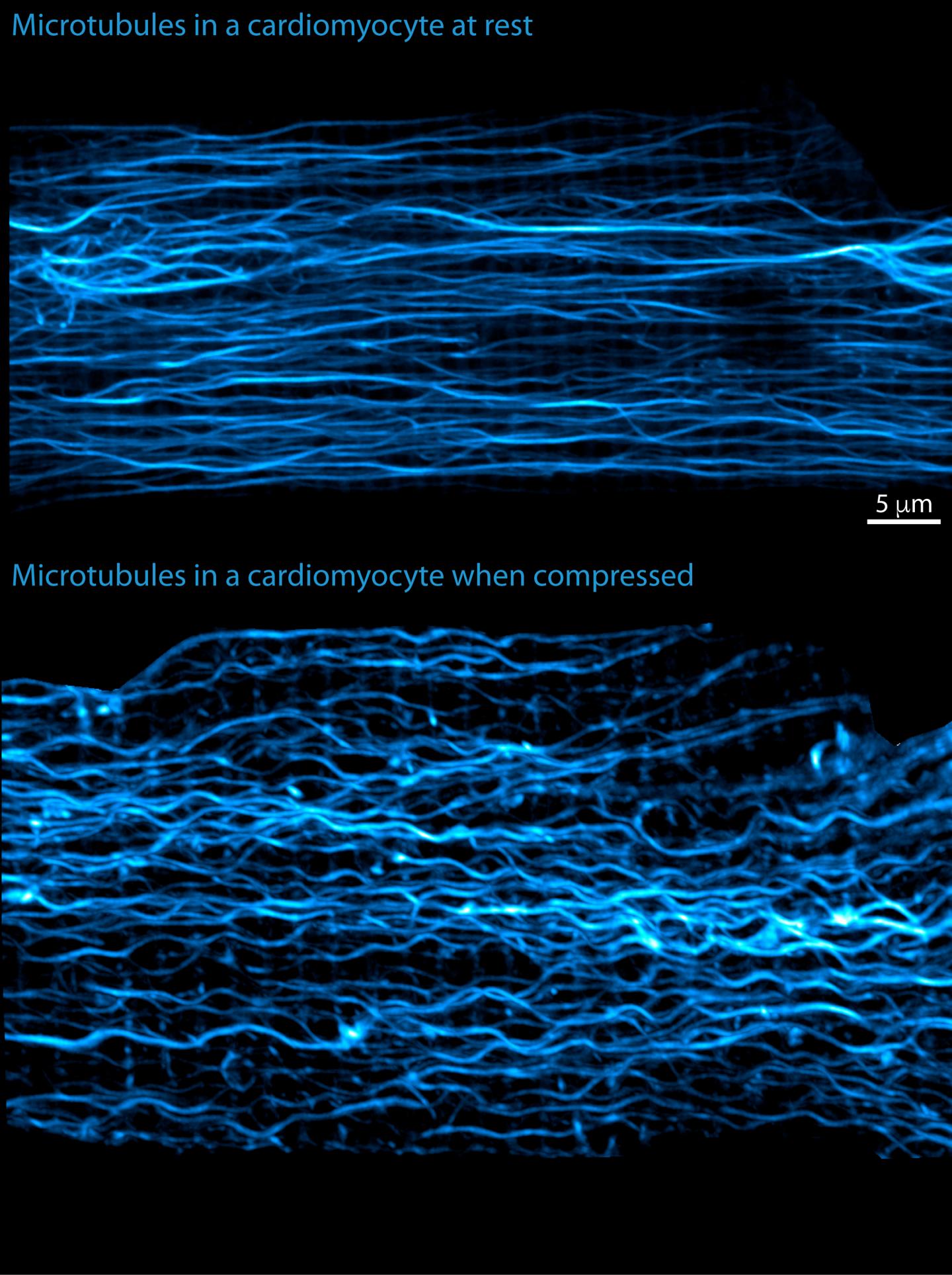 Microtuble Contractility (1 of 2)