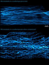 Microtuble Contractility (1 of 2)