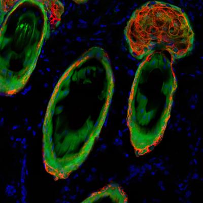 Transformed Cells