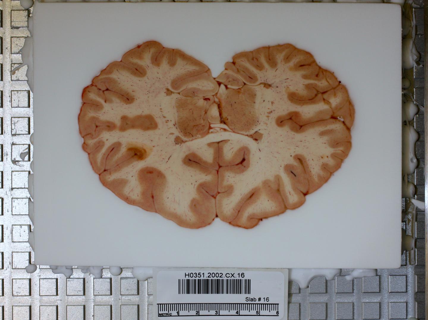 Sectioning of Tissue