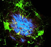 Cleanup of Alzheimer's Plaques Slowed