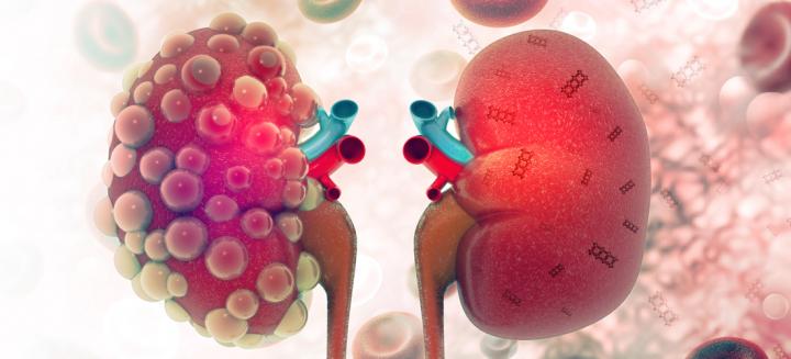 Kidney
