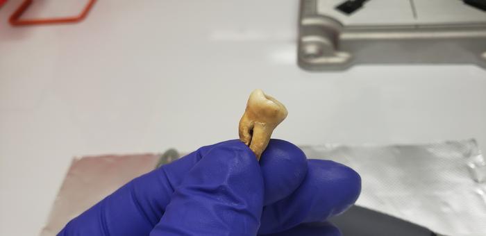 Jerash tooth 6 - May 2022 - Credit Greg O'Corry Crowe FAU