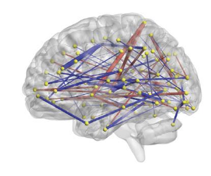 MRI Connections