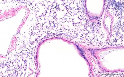 Neonatal Mice Exposed In Utero To Filtered Air And Challenged With The Allergen House Dust Mite