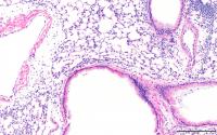 Neonatal Mice Exposed In Utero To Filtered Air And Challenged With The Allergen House Dust Mite