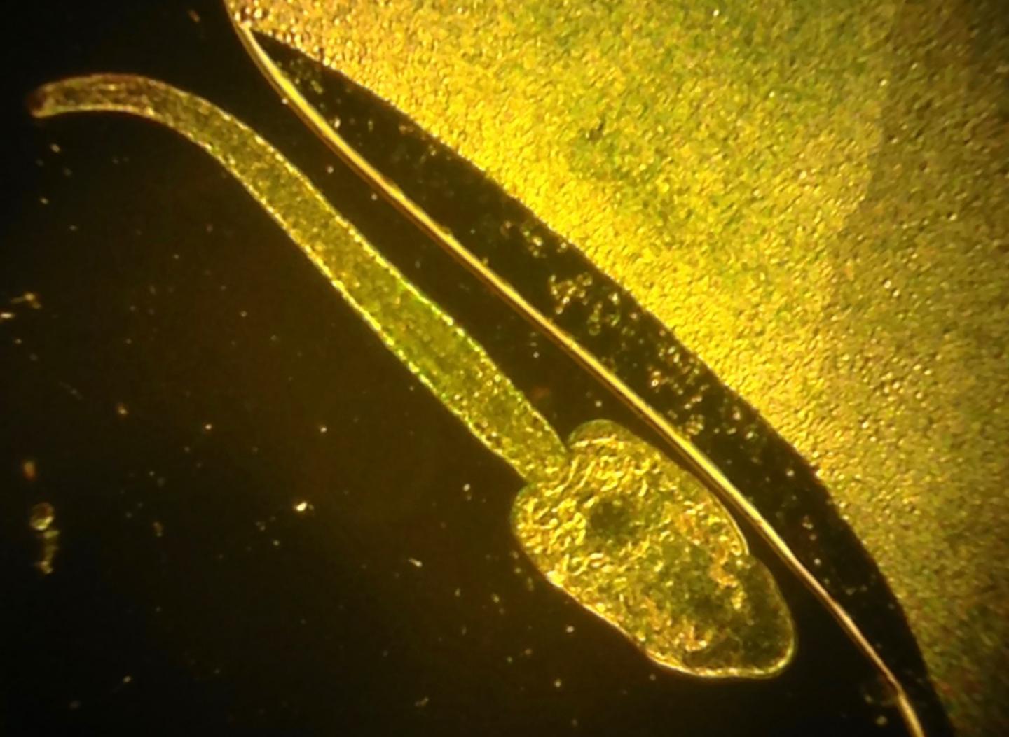 <i>Echinoparyphium</i> Lineage 3