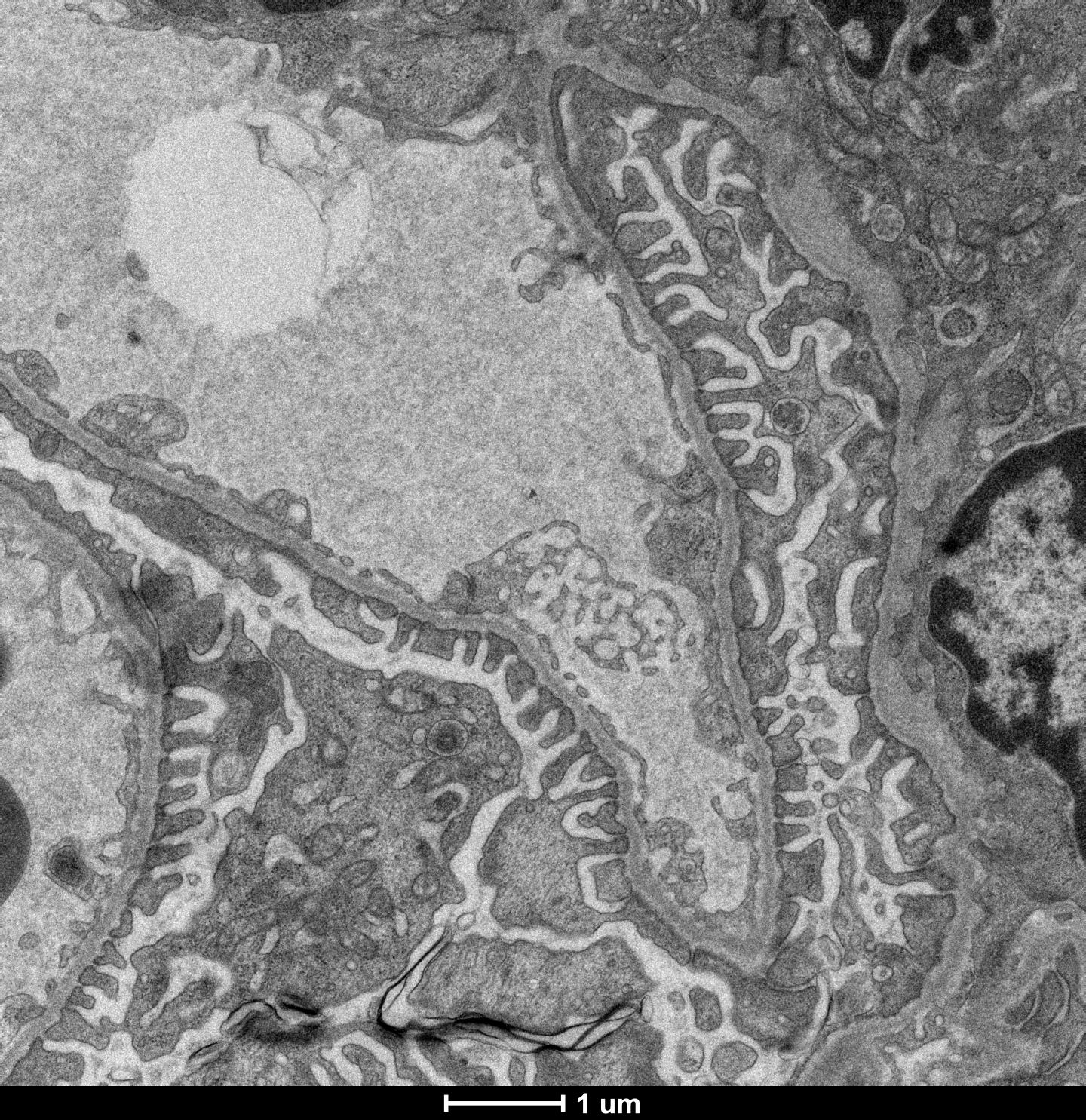 Kidney Podocytes