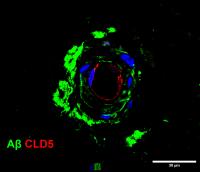 Amyloid-beta and Claudin-5 eurekalert