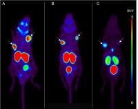 Maximum-Intensity Projections of F-18-PSMA-1007 PET