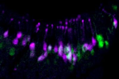 Vomeronasal Cells