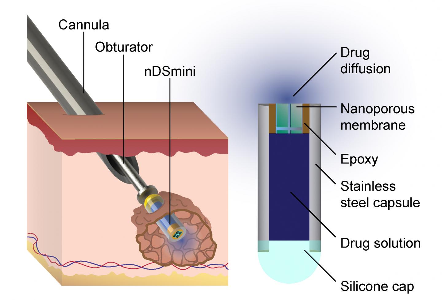 Diagram of Device