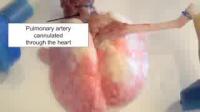 In Vitro Lung Tissue Engineering