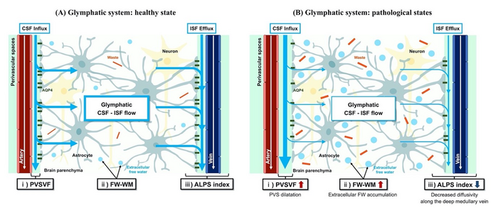 Basic concepts of the proposed MRI measures for indirect noninvasive evaluation of glymphatic system compartments in healthy and pathological states.