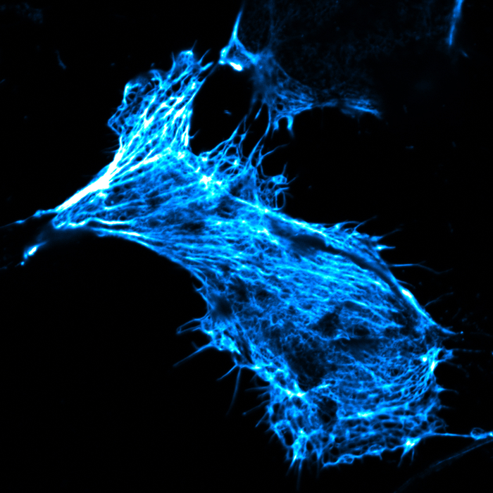 Microscope image of a living human cancer cell in culture.