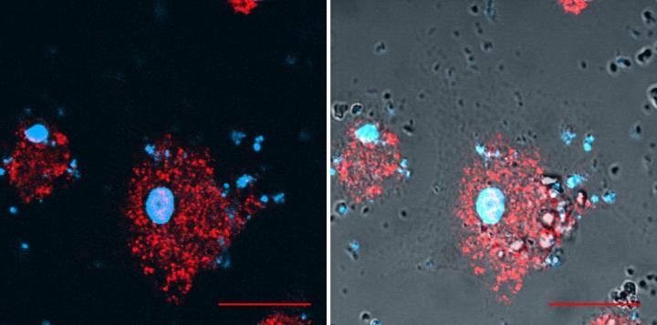 Dendritic Cell (A Type of Immune Cell) in a State of Stress Following Silica Exposure
