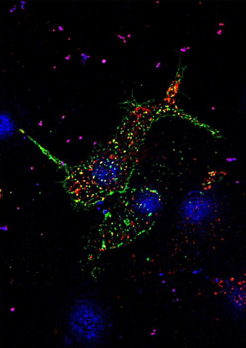 A pancreatic beta cell, taken in super-resolution under Zeiss-Elyra