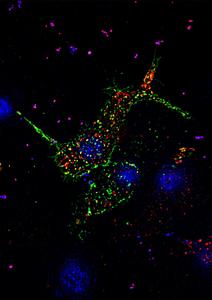 A pancreatic beta cell, taken in super-resolution under Zeiss-Elyra