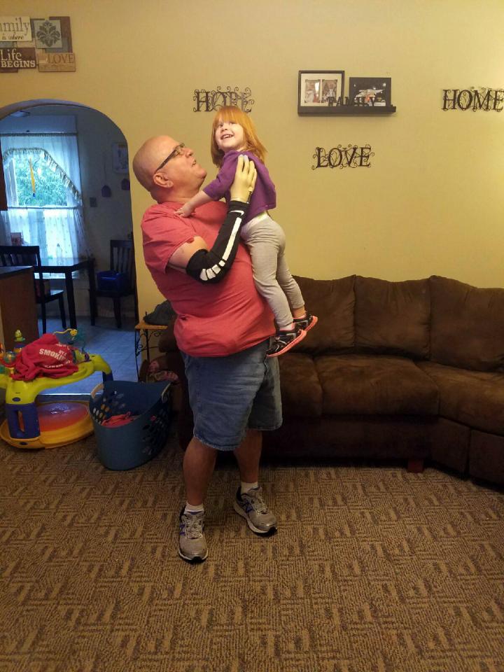 Super-Sensitive Prosthetic Allows Man to Hold Granddaughter