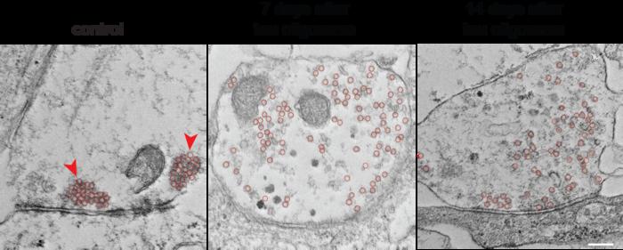 Electron microscopy images of synapse treated with or without tau oligomers