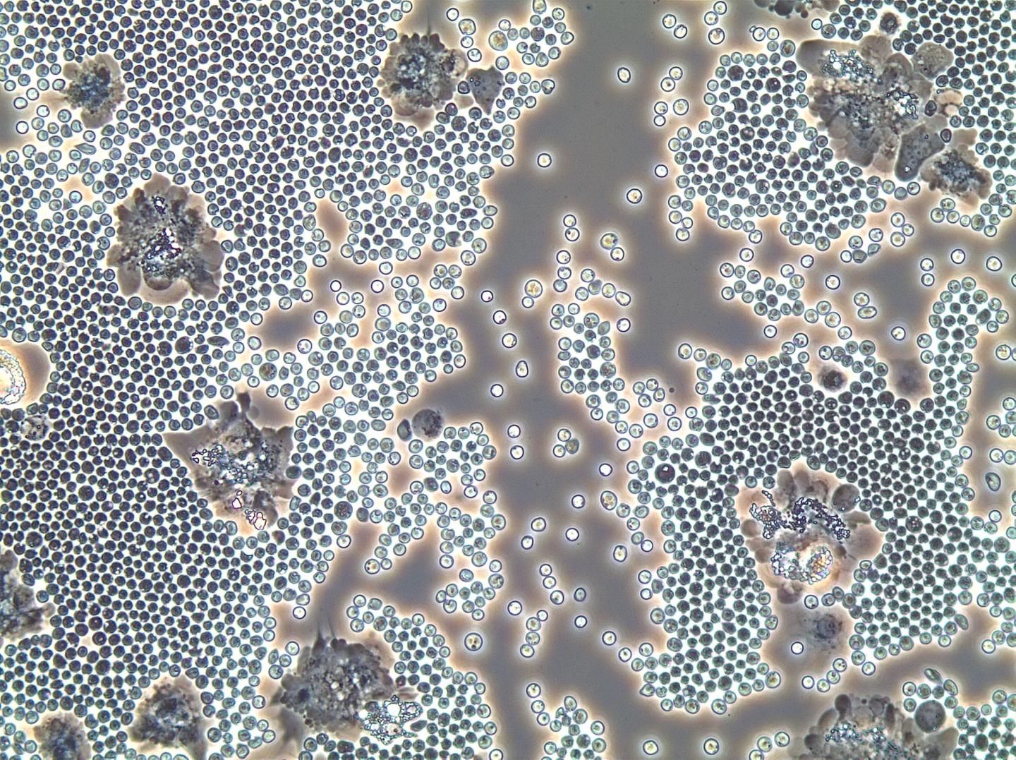 Crab Blood and Collaborations