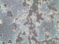 Crab Blood and Collaborations