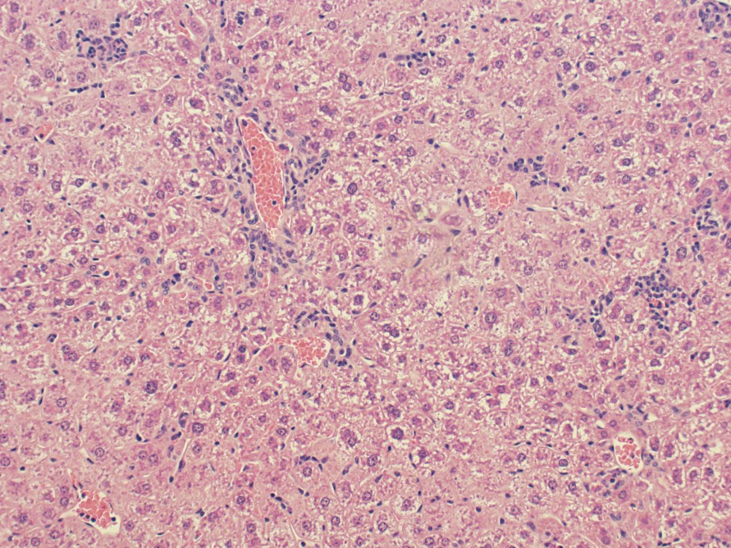 HE-OX40 Induces Hepatitis in WT Mice