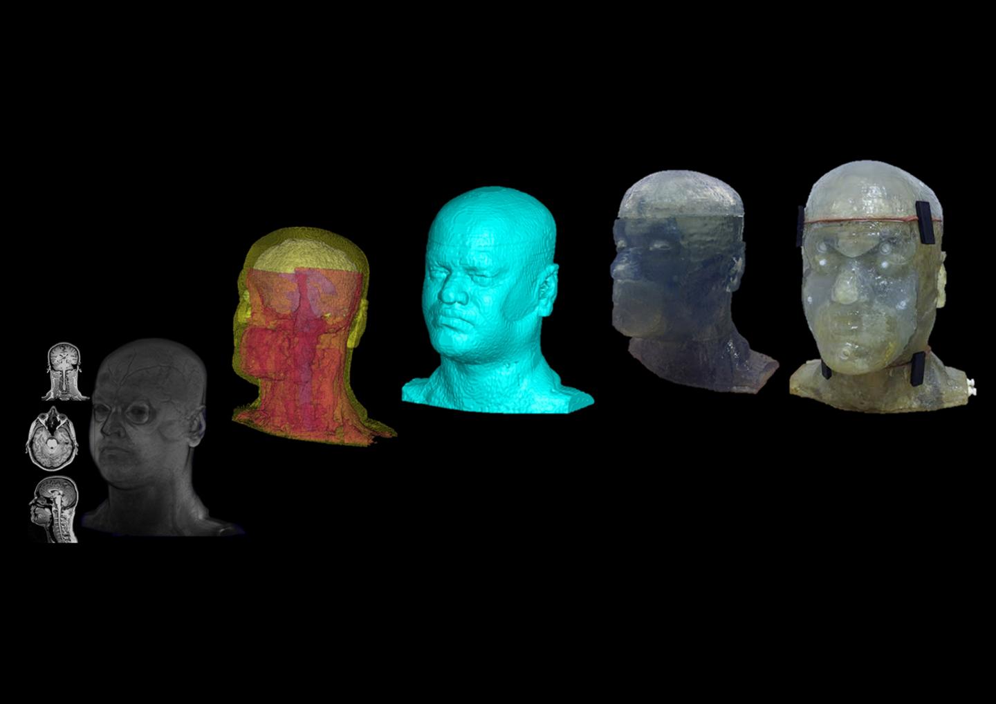 Depiction of the Phantom Head Development