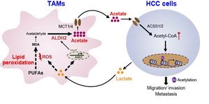 A schematic diagram depicts the metabolic interaction between HCC cells and TAMs