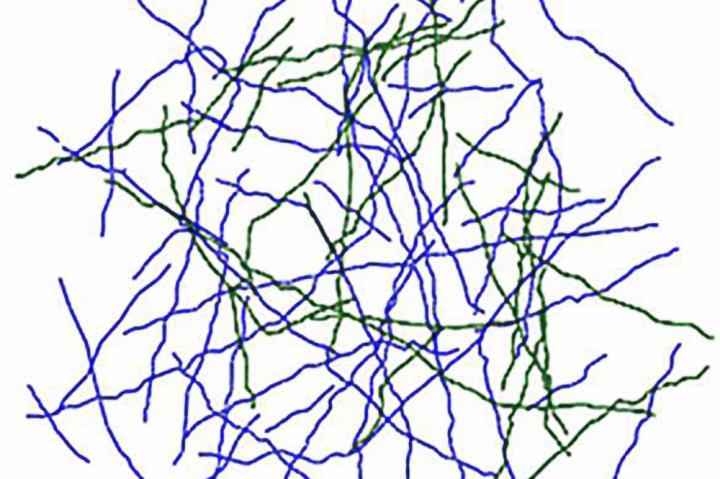 Axon Growth