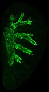 Cells expressing the basal cell marker KRT5 have been fluorescently labelled and can be seen spreading throughout the bronchial tree