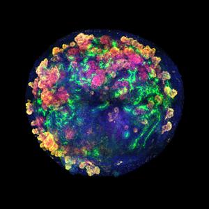 Kidney organoid