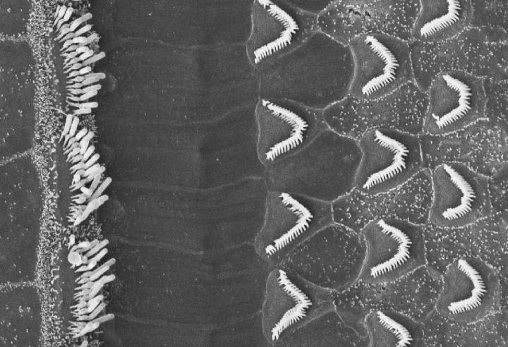 Inner and Outer Hair Cells from the Mouse Cochlea