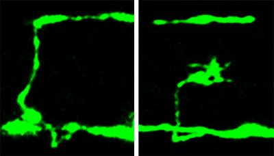 A Broken Nerve Cell